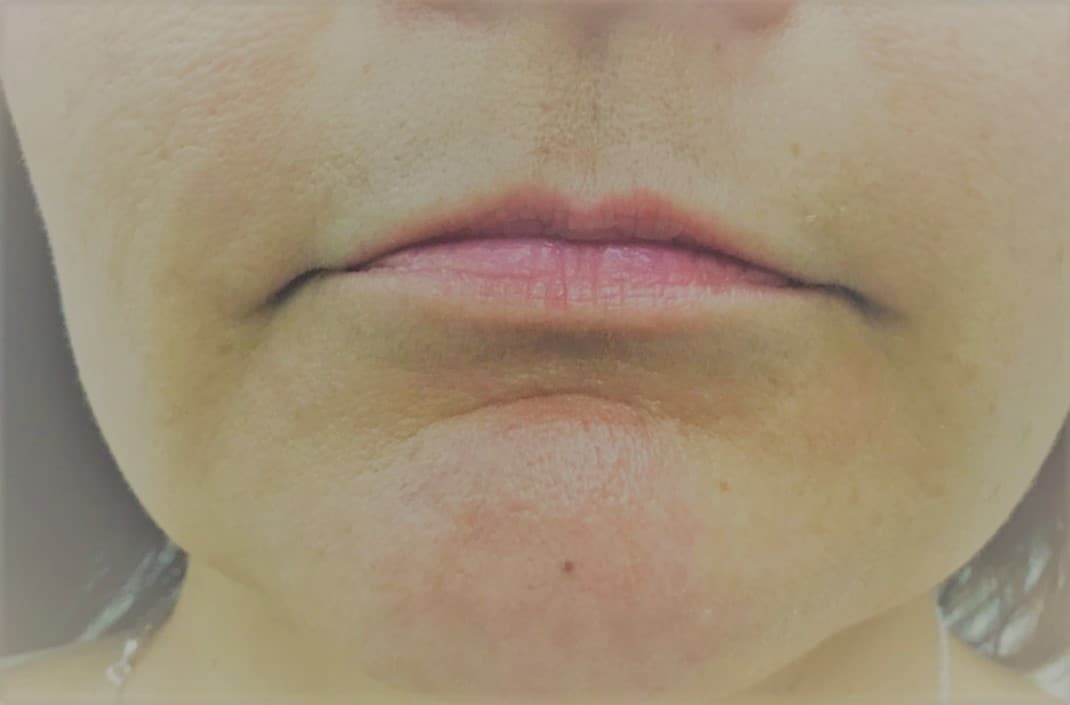 Before Image