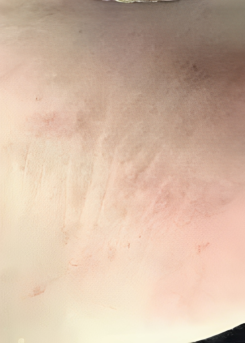 1693 imageset 1 after